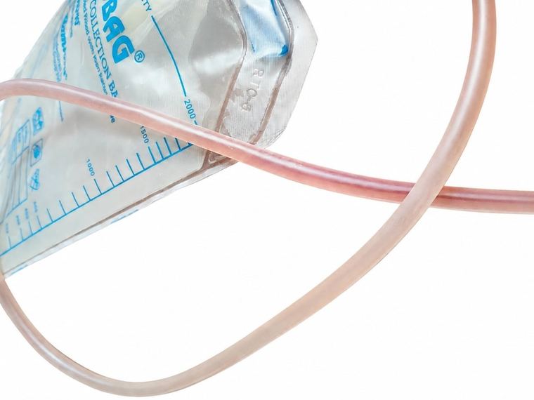 Pink, light red urine in the suprapubic catheter tube running to the urine bag
