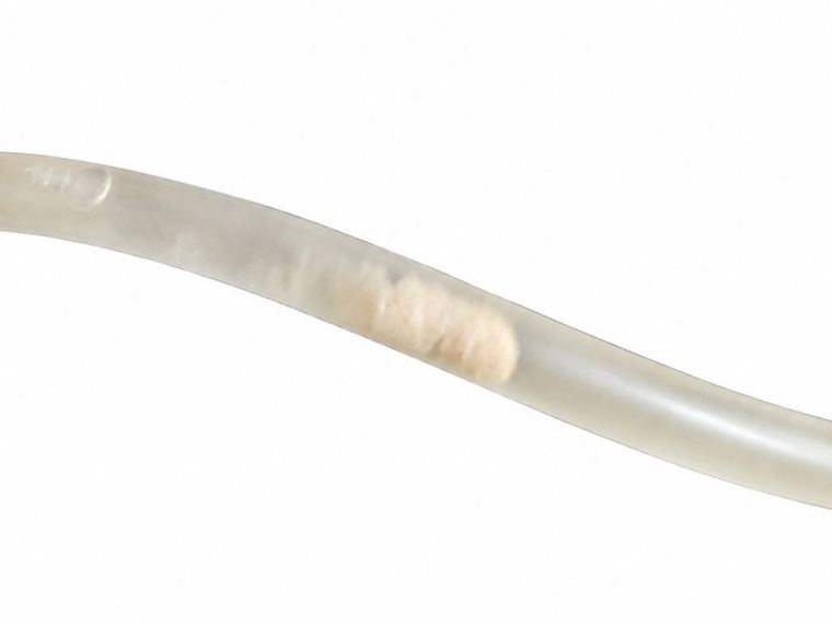 A plug of cloudy, creamy material is mucus and mineral debris coating the plastic, not something wrong with your urine.